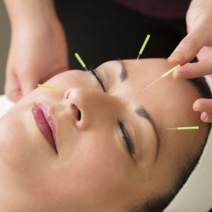 Spa series: middle aged woman in the spa getting acupuncture treatment. You might also be interested in these: